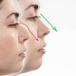 Rhinoplasty in Riyadh Profile Picture
