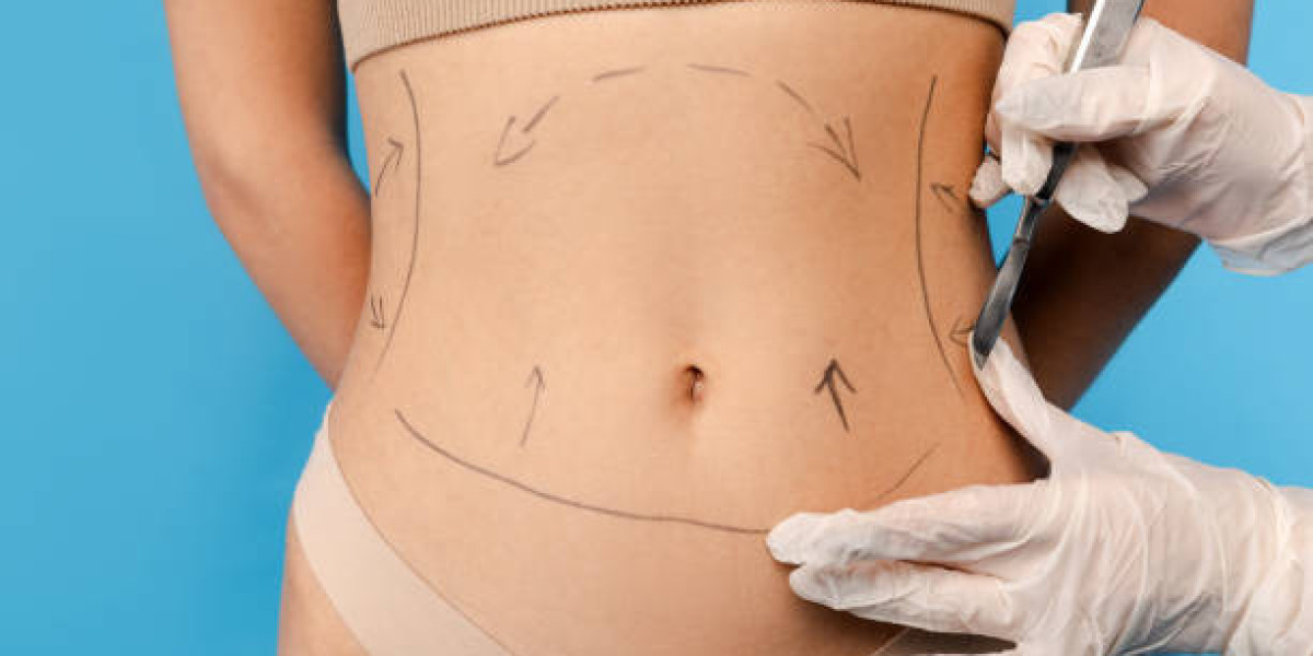 What Incision Sizes in Liposuction Procedure?