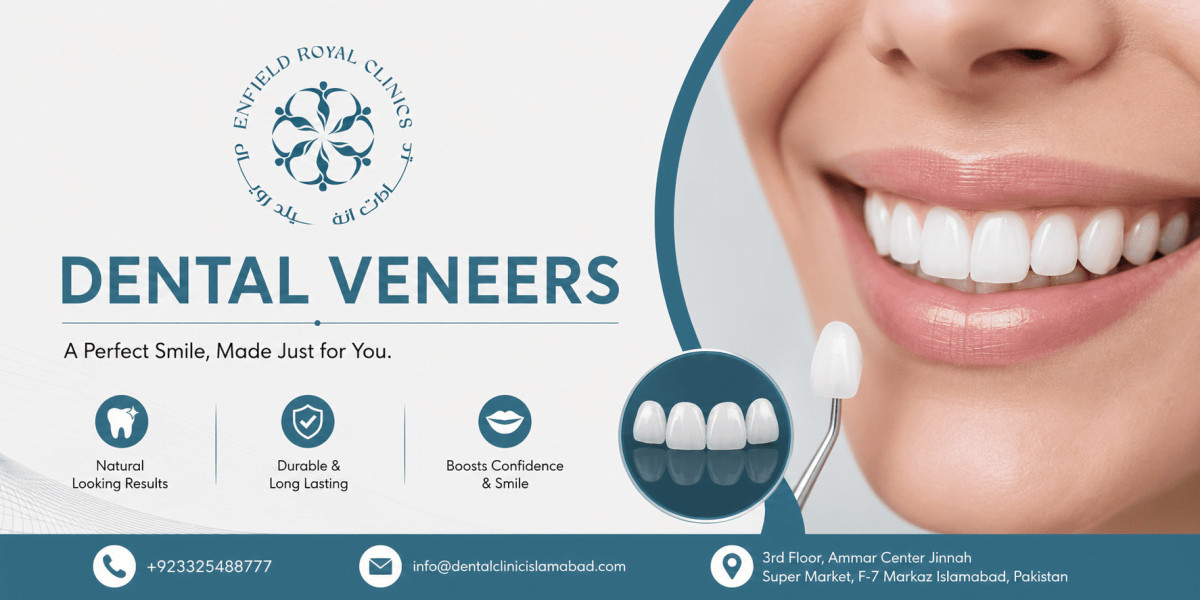 Dental Veneers in Islamabad to Improve Tooth Shape and Colour