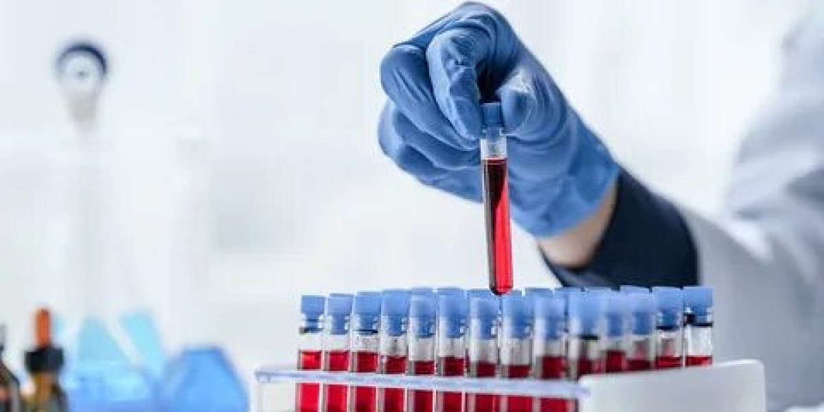 Lab Test at Home: Key Advantages for Modern Healthcare