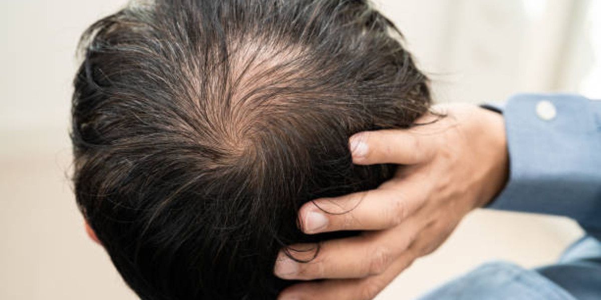 How PRP Hair Treatment Supports Healthier Hair Growth