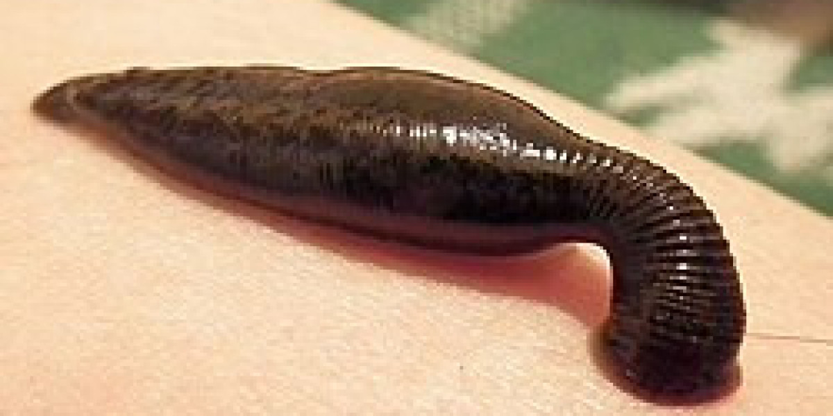 How Leech Therapy in Sakinaka Supports Natural Recovery and Better Well-Being