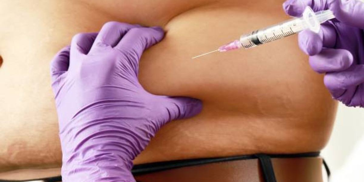 Fat Melting Injections in Riyadh: Results, Recovery Tips, and What to Expect