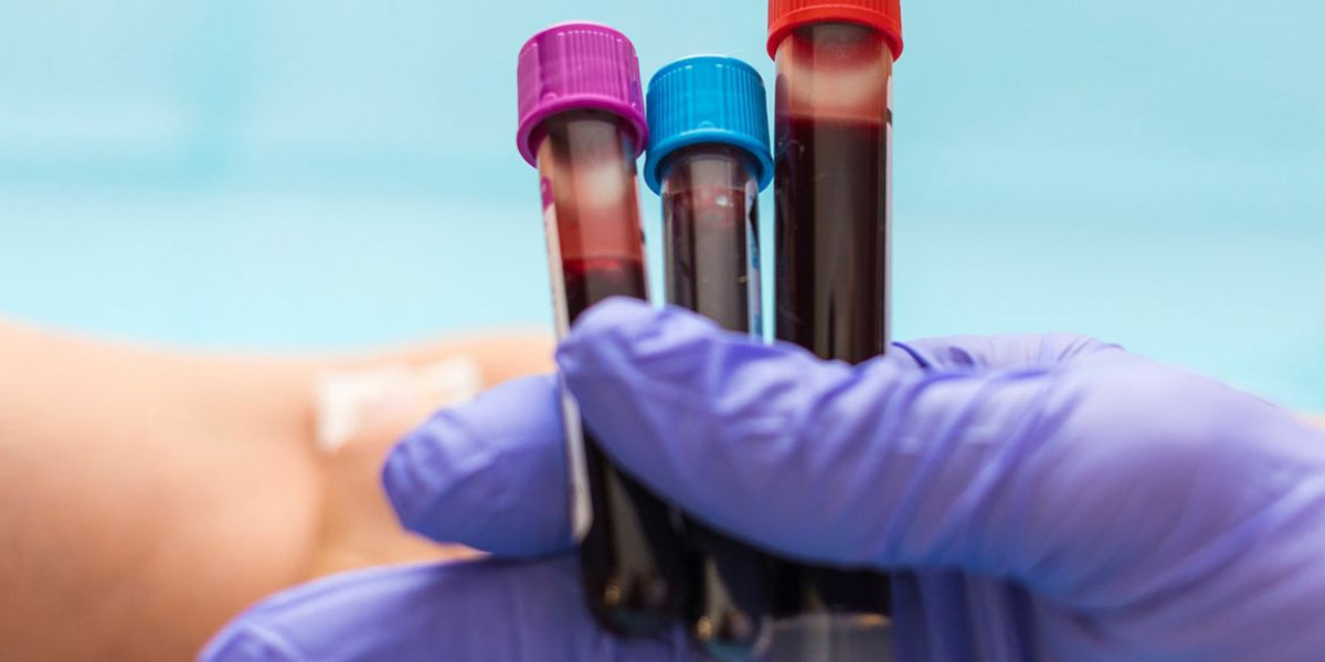 When Should You Get a Blood Test? Key Signs and Reasons