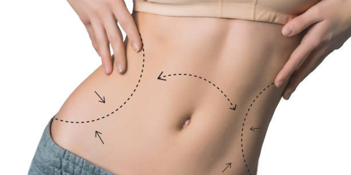 Recovery Tips for Your Mommy Makeover Journey in Riyadh