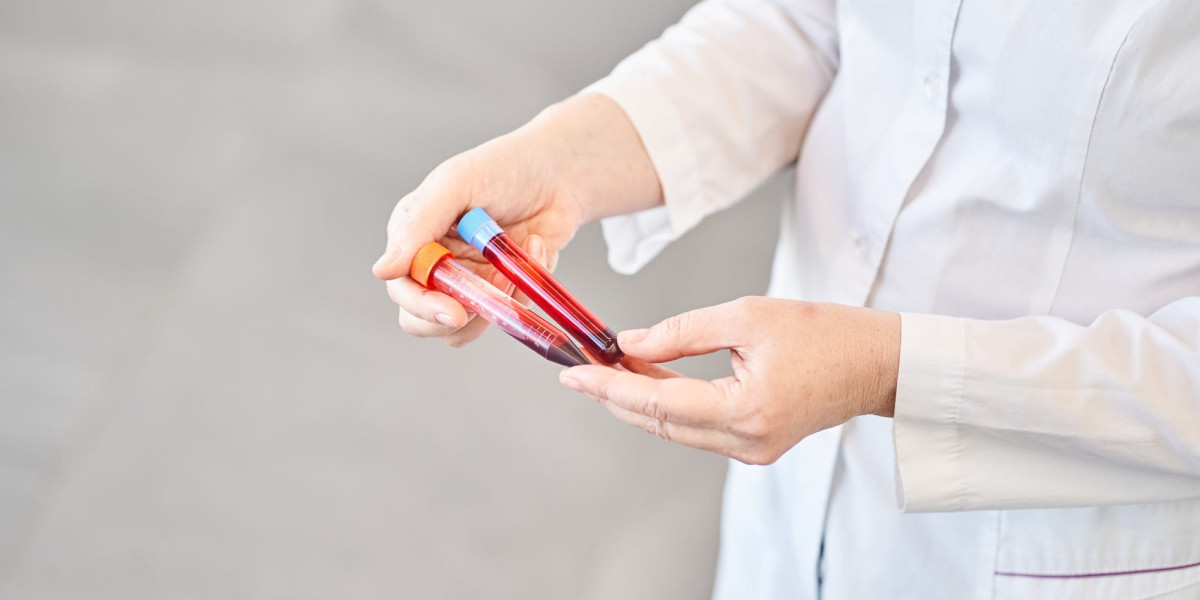 Visa Blood Test Preparation: What Should You Know Before Testing?