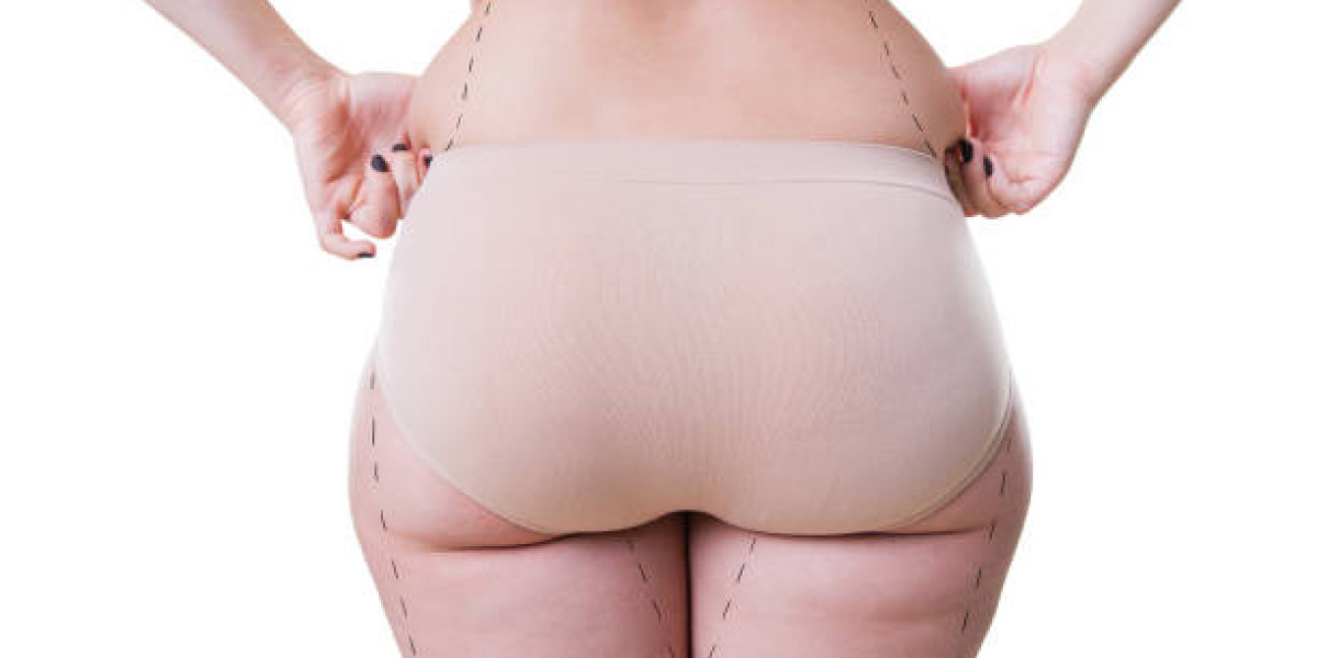 Mommy Makeover in Riyadh and Its Role in Post Pregnancy Body Renewal