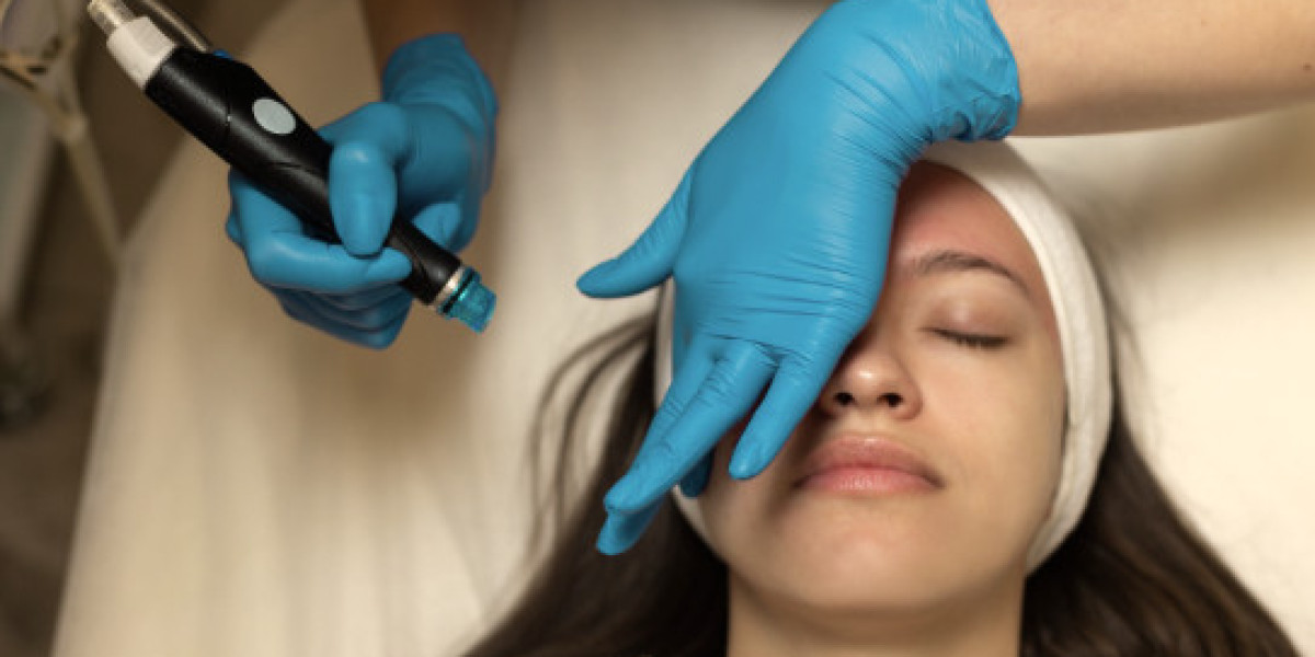 Pairing a HydraFacial With Acupuncture: A Wellness Day That Covers More Ground