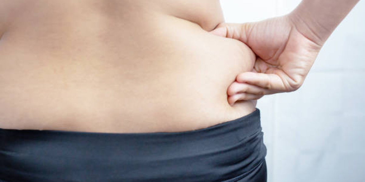 Liposuction in Riyadh at Enfield Royal Clinic