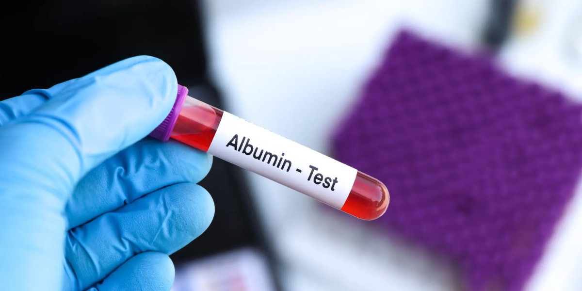 How Does an Albumin Blood Test Work? Procedure, Preparation, and Results
