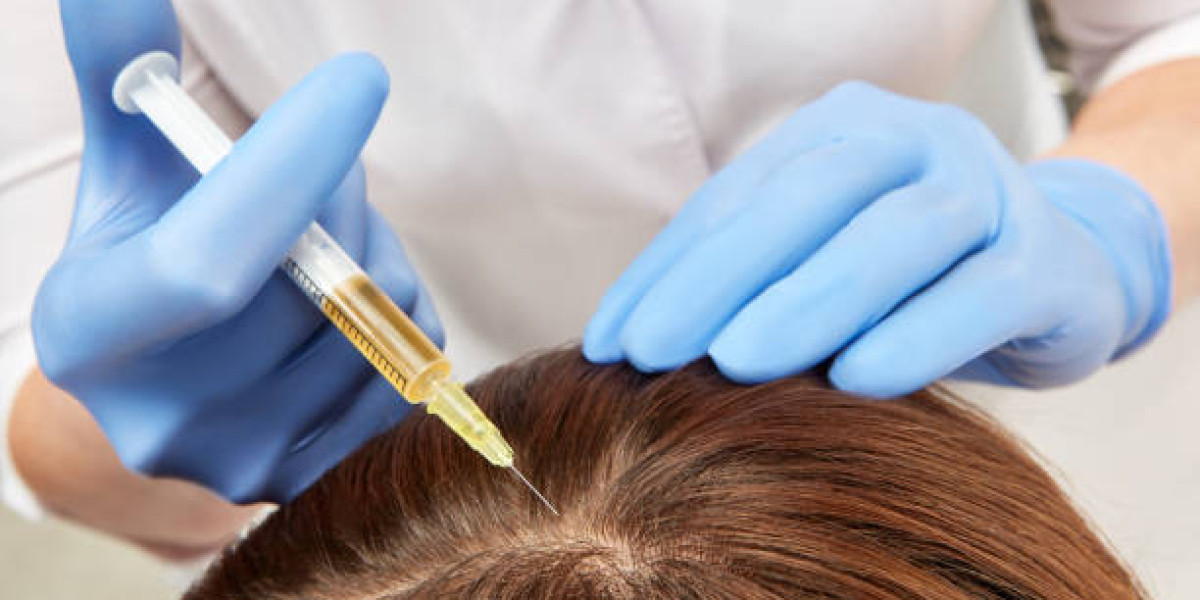 Understanding the Science Behind PRP Hair Treatment