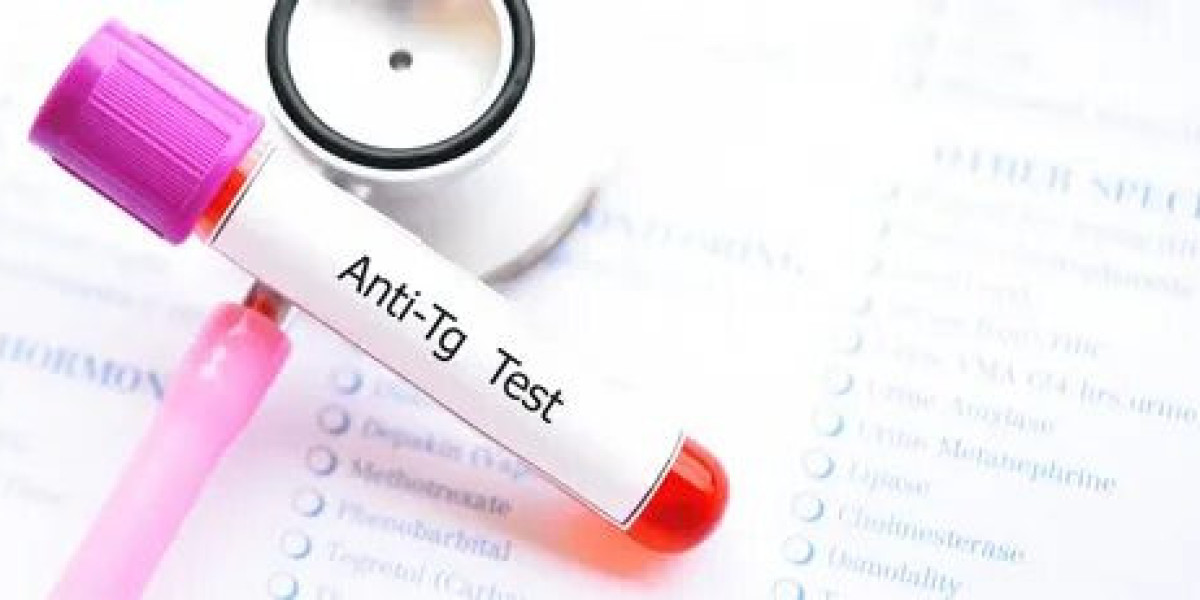Thyroglobulin Antibodies Test: Everything You Need to Know