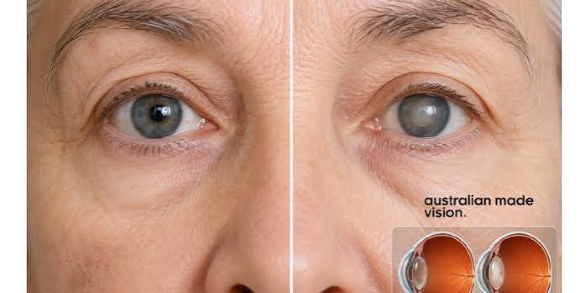 Cataract Surgery in Australia A Practical Guide to Clear Vision