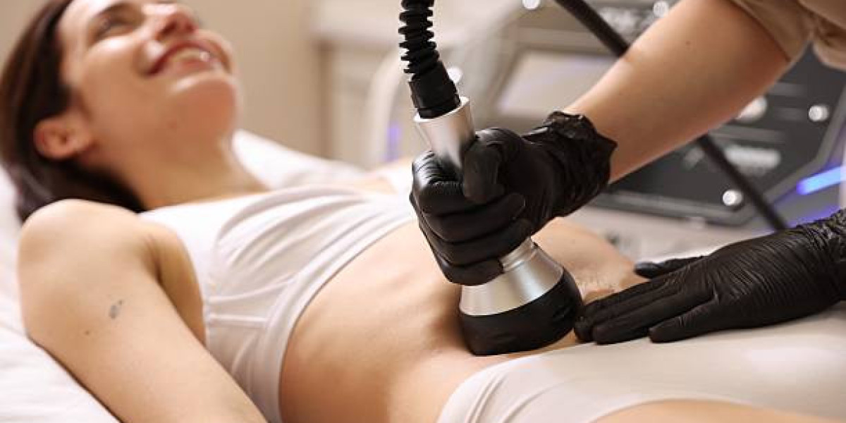Common Myths About Venus Legacy Treatment