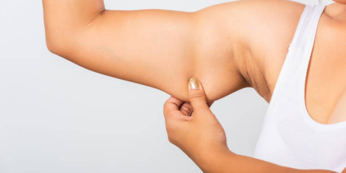 Arm Lift Surgery and Lifestyle Changes Before the Procedure