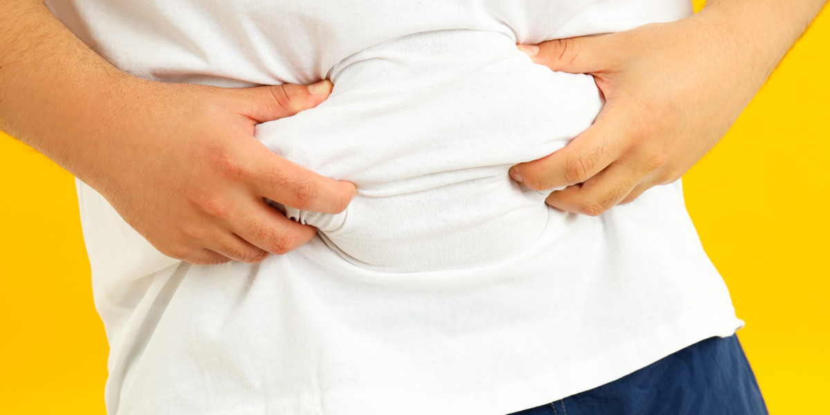 Top Wellness Centers for Gastric Sleeve Surgery Dubai Cost
