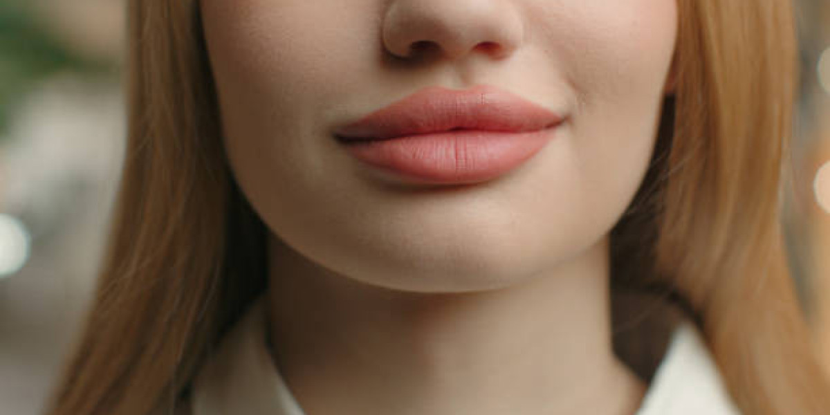 How Lip Fillers Improve Lip Shape and Definition