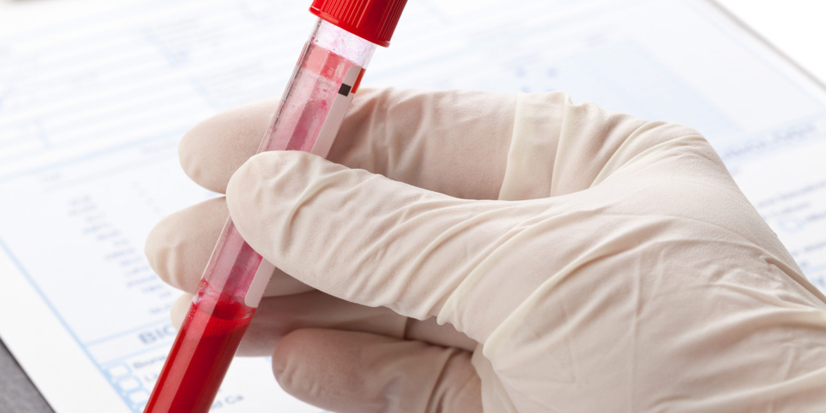 Blood Urea Nitrogen Test for Kidney Function: From Testing to Results