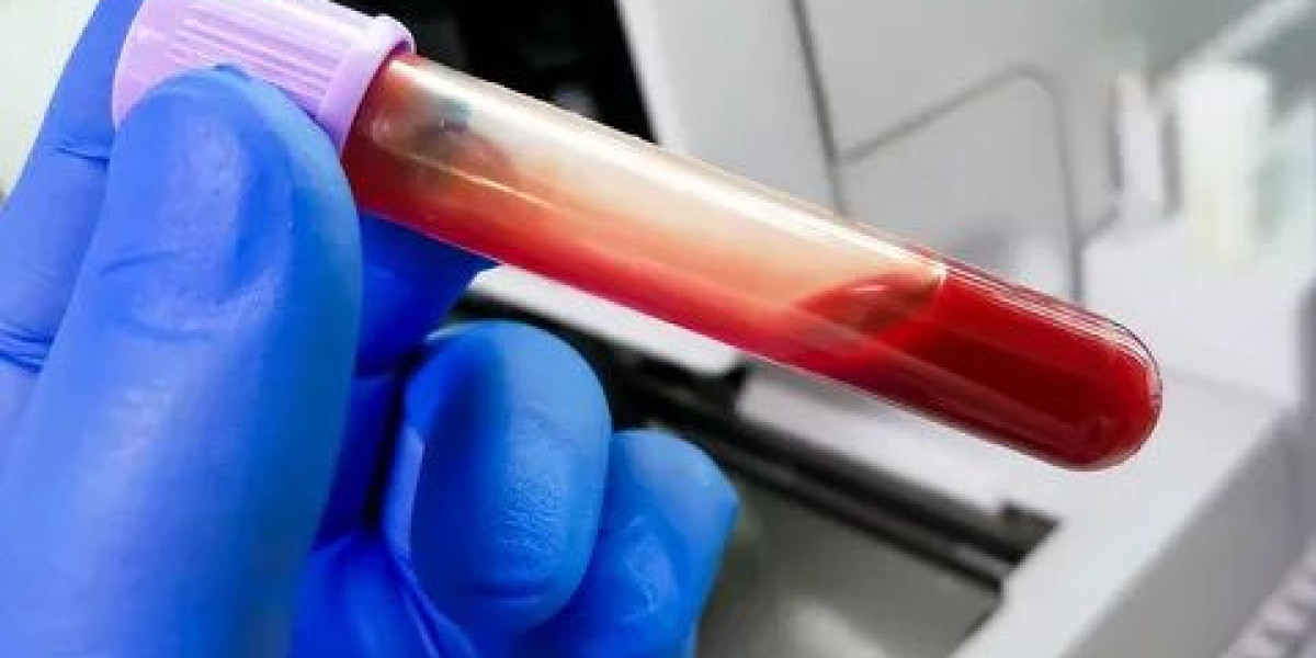 What Is a Carcinoembryonic Antigen Blood Test and Why Is It Done?